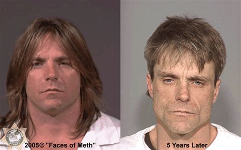 Photos Before And After Mugshots Of Meth Users Wjla