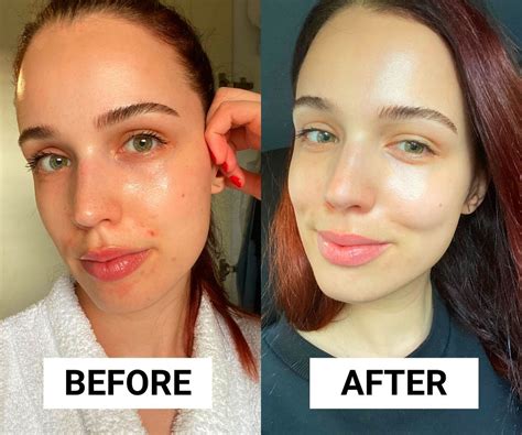 ** Tinh Chất Trị Mụn, Chống Lão Hóa LA ROCHE-POSAY Retinol B3 Serum