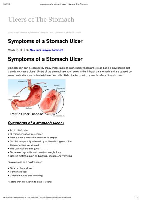 Symptoms Of A Stomach Ulcer Ulcers Of The Stomach Peptic Ulcer