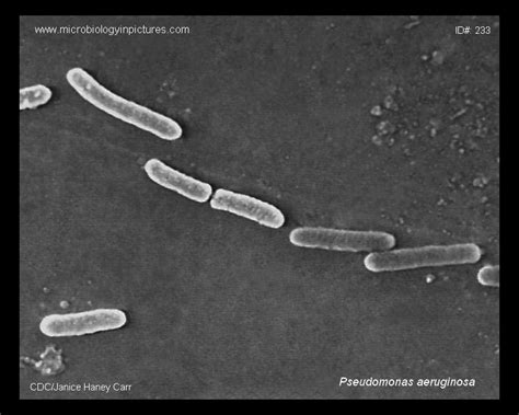 Pseudomonas Aeruginosa Sem Micrograph Scanning Electron Micrograph