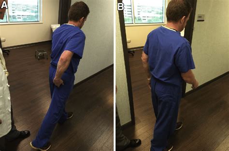 The Long Stride Walking Test Is Intended To Provoke Impingement Between