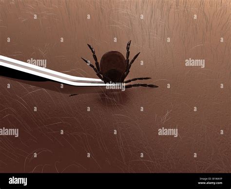 Tick Tweezers Hi Res Stock Photography And Images Alamy