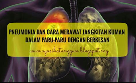 Maybe you would like to learn more about one of these? Sihat Itu Nikmat - HEALTH | BISNES | FAMILY: PNEUMONIA DAN ...