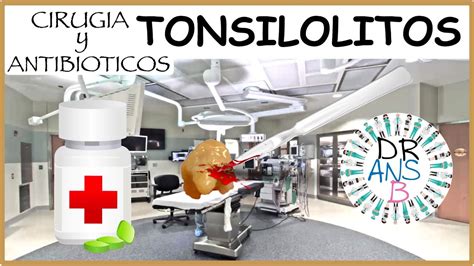 Tonsilolitos Cirugía Y Antibióticos Youtube