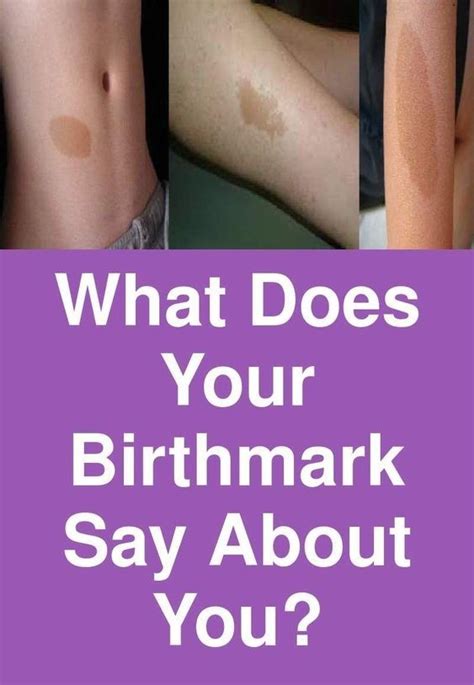 What Does Your Birthmark Say About You Secret Of Longevity