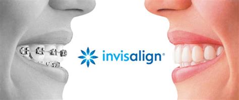 Invisalign Modern Dentistry Professional Dentists In Brooklyn