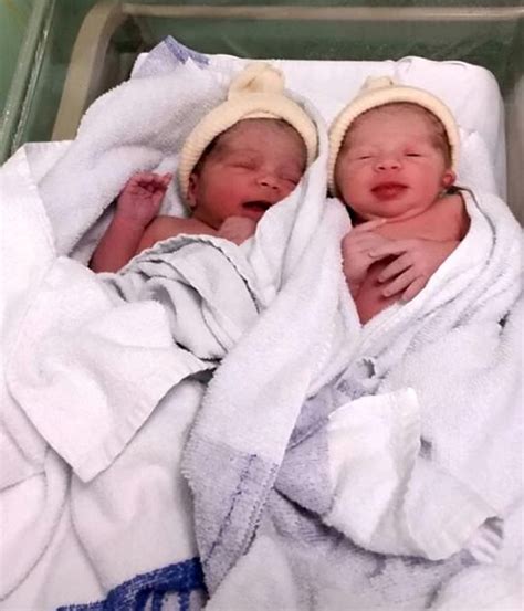 Meet The One In A Millon Twin Girls Who Were Born With Different