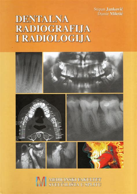 Dentalna Radiografija I Radiologija Antikvarijat Bono