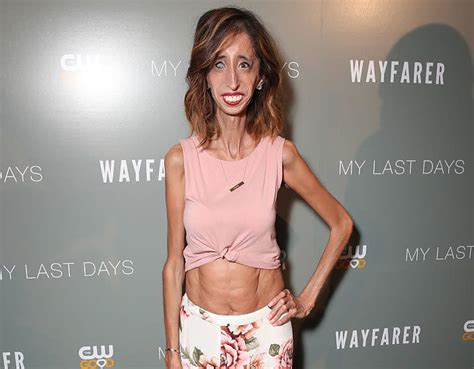 Here Is Another Reminder That “worlds Ugliest Woman” Lizzie Velasquez Is Such An Incredible