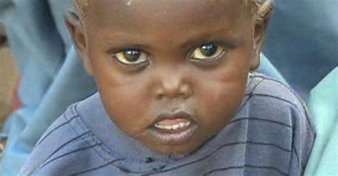 300000 Children In Danger Of Starvation Cbs News