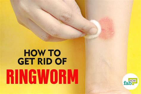 How To Get Rid Of Ringworm Kill The Infection With Home Remedies