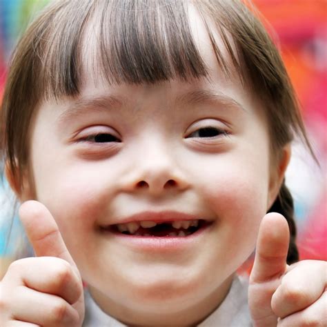 11 Facts About Down Syndrome