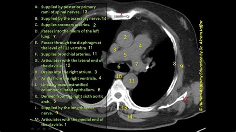 Identifying Axial Ct At The Superior Mediastinum Youtube