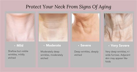 How To Treat Reduce And Prevent Neck Wrinkles And Sagging