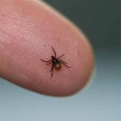 The Best Ways To Prevent And Remove Ticks Lyme Disease Lyme Disease
