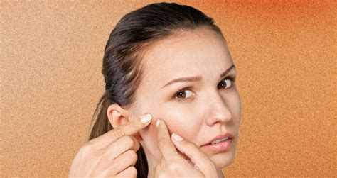 Acne Holes And Scarring On The Face Types Therapy Cost