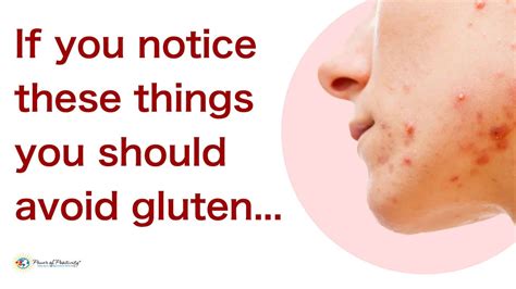 Does Your Gluten Rash Look Like These 5 Photos Gluten