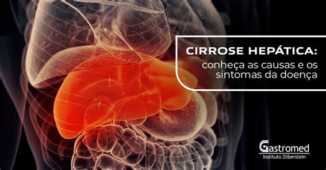 Qual Os Sintomas Da Cirrose