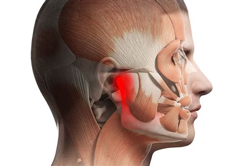 Everything You Need To Know About Tmj Disorder