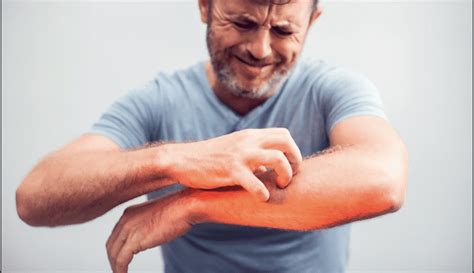 A Guide To Protect Yourself From Work Related Skin Allergies Casbuzz