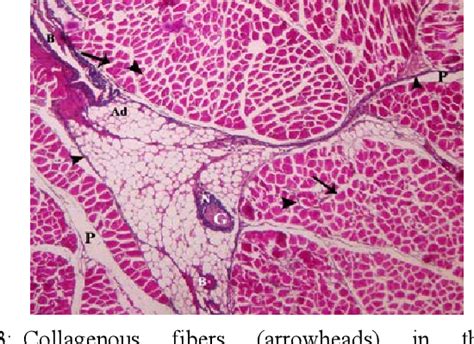 Figure 3 From Comparative Histological Studies Of Intramuscular