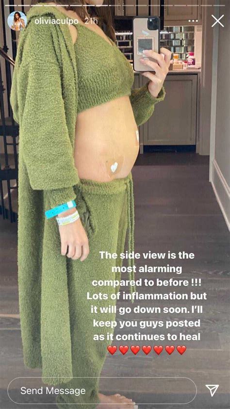 Olivia Culpo Just Underwent Surgery For Endometriosis After Years Of