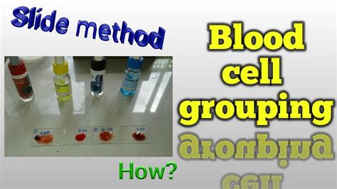 Blood Cell Grouping Slide Method In Hematology Blood Bank Youtube