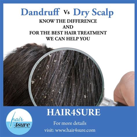 Dandruff Vs Dry Scalp Hair Treatment Hair Transplant Hair Care