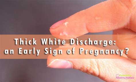 White Discharge During Pregnancy
