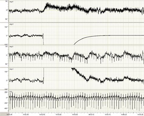 Pdf An Introduction To Eeg Artifacts Semantic Scholar