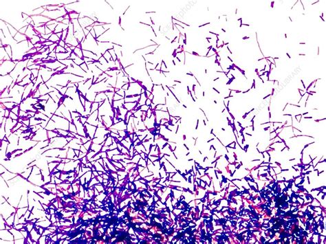 Gram Positive Bacteria Stock Image C0014060 Science Photo Library