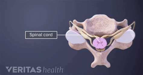 Cervical Vertebrae Definition | Back Pain and Neck Pain Medical Glossary