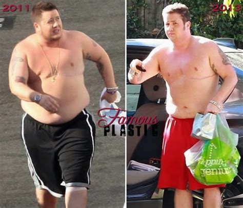 Chaz Bono Plastic Surgery Before And After Weight Loss Photos. 