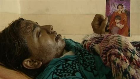 Pakistani Women S Lives Destroyed By Acid Attacks Bbc News
