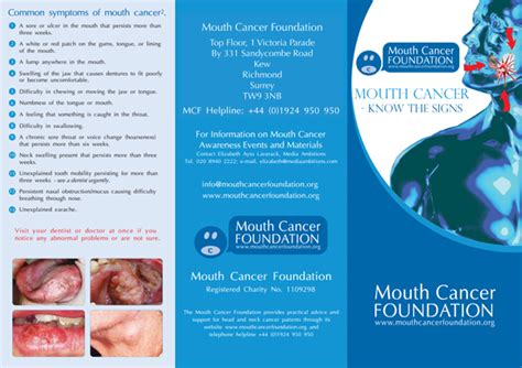 Know The Signs And Symptoms Of Mouth Cancer Mouth Cancer Foundation