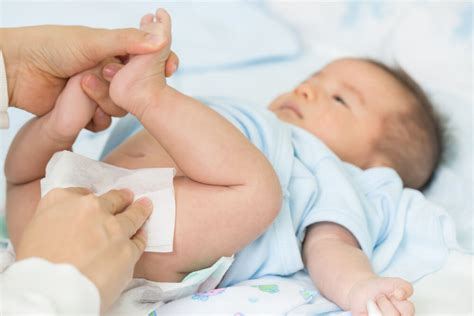 How To Clean A Newborn Circumcision Chicagojewishnews Com