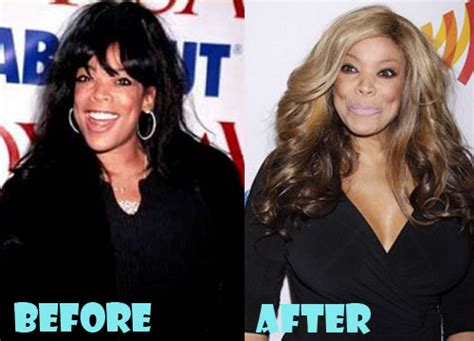 Wendy Williams Plastic Surgery Before And After Pictures Lovely