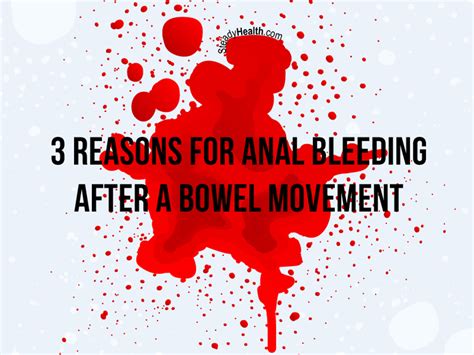 3 Reasons For Anal Bleeding After A Bowel Movement Gastrointestinal