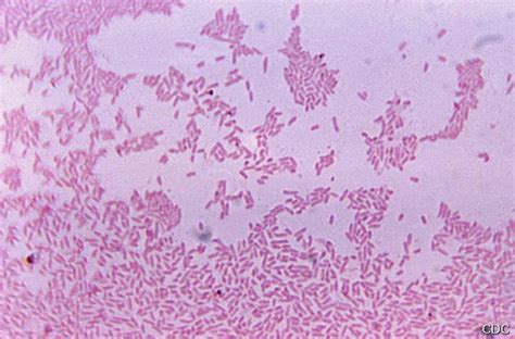 What Is Gram Negative Bacteria Images And Photos Finder