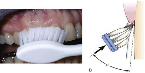 Tooth Brushing Techniques News Dentagama
