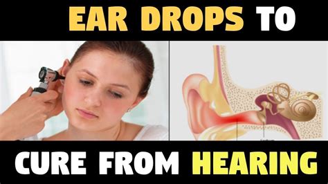 Use This Very Effective Ear Drops To Cure Hearing Problems Youtube