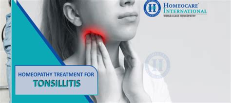 Homeopathy Treatment For Tonsillitis Homeocare International