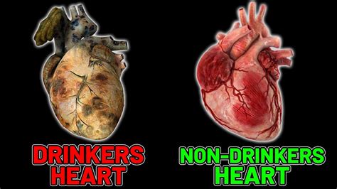 This Is How Alcohol Affects The Heart Science Explained Youtube