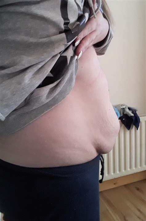 With insufficient supply of water to the body, the liver, which is highly an important organ for burning fat, starts functioning slowly. How To Lose C Section Pouch