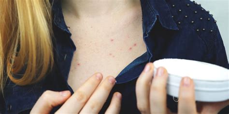 How To Treat Chest Acne According To Dermatologists Popsugar Beauty