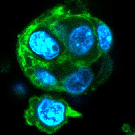 Group uses organoid to explain immune cells’ rapid response | Cornell