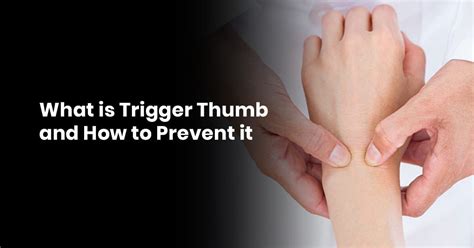 What Is Trigger Thumb And How To Prevent It Recurve Bow Hunting