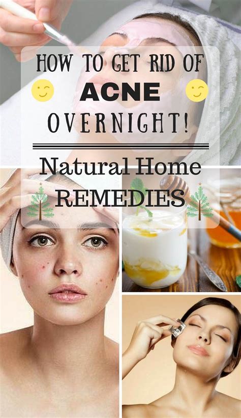 How To Get Rid Of Acne Overnight Naturally At Home Effective Acne