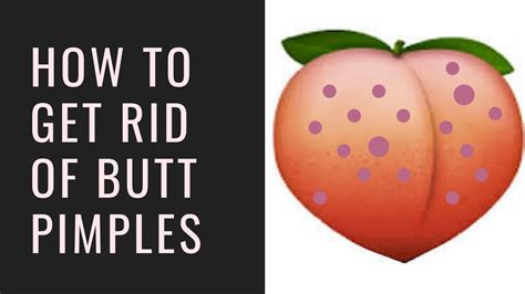 how to get rid of butt pimples youtube