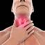 Sore Throat Illustration Stock Photo  Download Image Now IStock